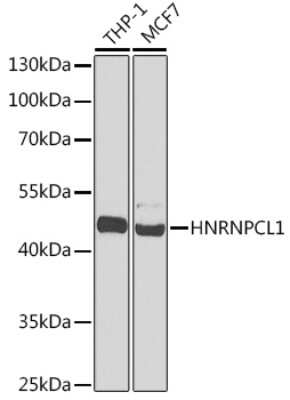Western Blot: HNRNPCL1 Antibody [NBP3-05586] - Western blot analysis of extracts of various cell lines, using HNRNPCL1 antibody (NBP3-05586) at 1:1000 dilution. Secondary antibody: HRP Goat Anti-Rabbit IgG (H+L) at 1:10000 dilution. Lysates/proteins: 25ug per lane. Blocking buffer: 3% nonfat dry milk in TBST. Detection: ECL Basic Kit. Exposure time: 90s.